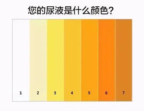 尿液颜色.jpg