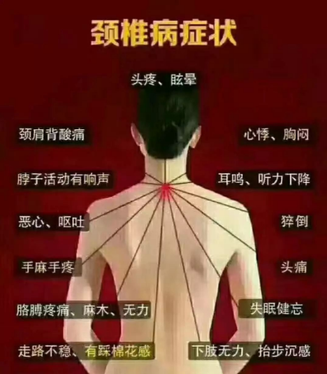 颈肩痛，你还认为是小事儿吗?看看颈椎病的十五大危害！！